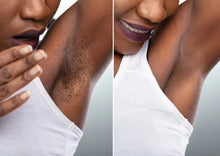 Load image into Gallery viewer, Laser Hair Removal Kit