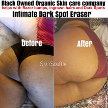 Load image into Gallery viewer, Twin (2) Pack Intimate Dark Spot Eraser