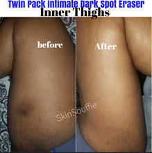 Load image into Gallery viewer, Twin (2) Pack Intimate Dark Spot Eraser