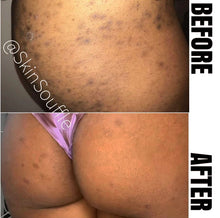 Load image into Gallery viewer, Triple (3) Pack Dark Spot Eraser