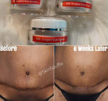 Load image into Gallery viewer, Scar Eraser