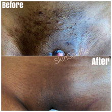 Load image into Gallery viewer, Intimate Razor Bump Corrector