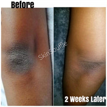 Load image into Gallery viewer, Intimate Razor Bump Corrector & Dark spot Eraser Combo