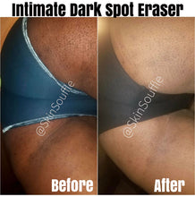 Load image into Gallery viewer, Intimate Dark Spot Eraser & Turmeric Brightening Soap Combo Pack