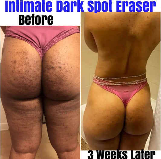 Intimate Dark Spot Eraser