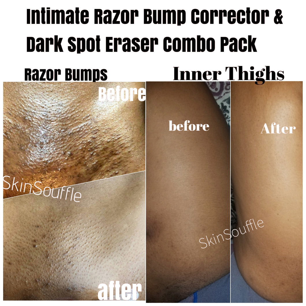 Intimate Razor Bump Corrector & Dark spot Eraser Combo
