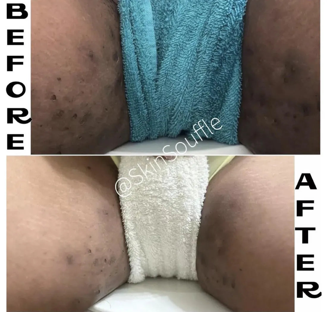 Customer before and after