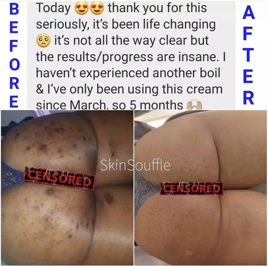 Customer before and after, 5 months