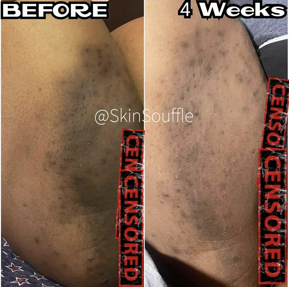 Customer before and after, 4 weeks