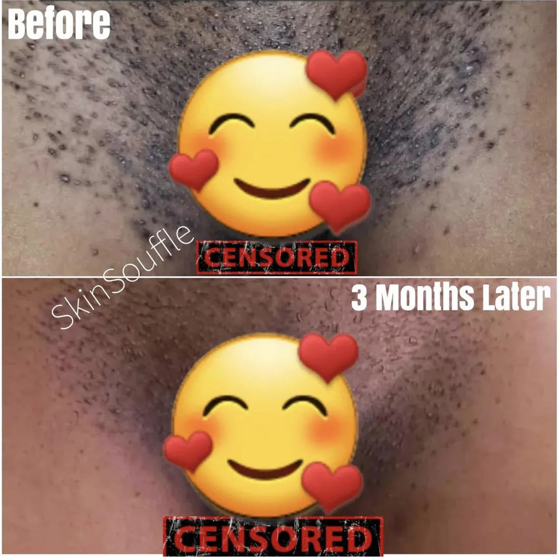 Customer before and after, 3 months